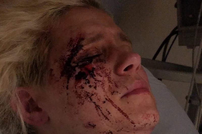 Trans Person Beaten Bloody on Capitol Hill