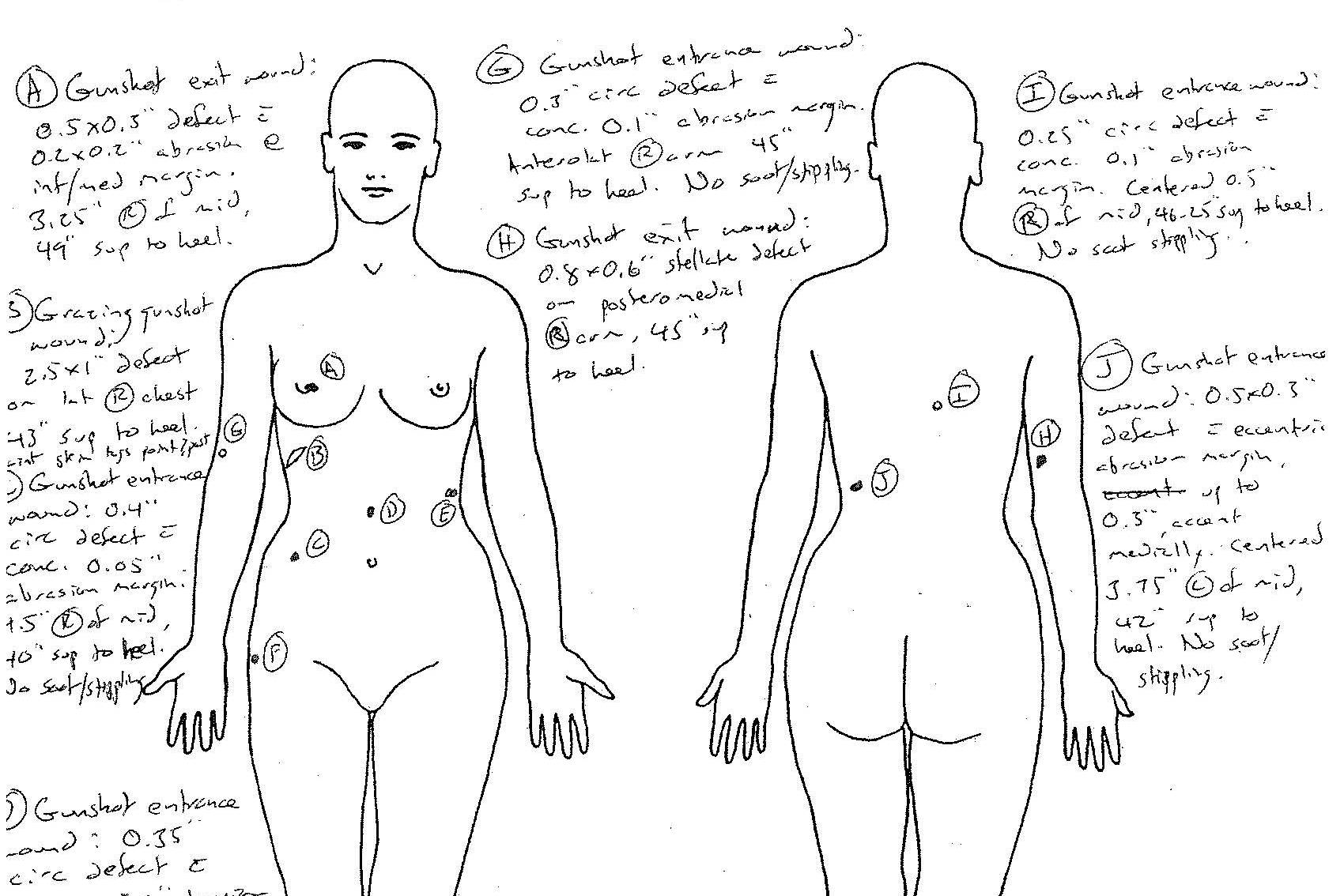 A diagram from the county Medical Examiner showing where the bullets hit Lyles’ body. Document provided by Karen Koehler