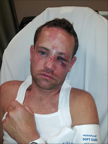 It’s a shame that steroid﻿ saturated, sexist homophobes are invading every major