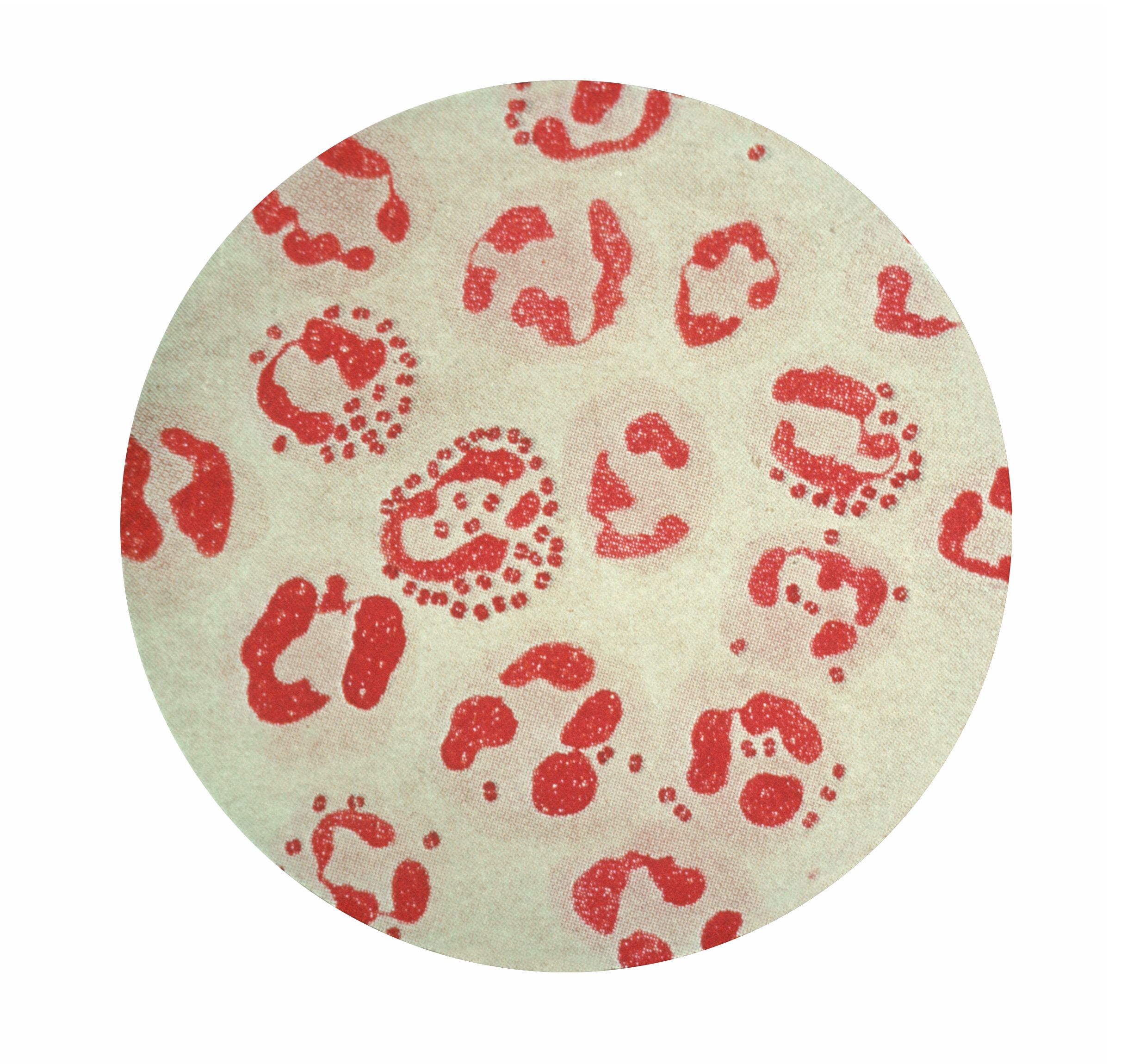 Photomicrograph of <i>Neisseria gonorrhoeae</i> (gonococcus) from urethral discharge (acute gonorrheae). gram stain. Causes Gonorrhea, second only to chlamydial infections in the number of cases reported to the CDC.Division of AIDS, STD, and TB Laboratory Research_Neisseria gonorrhoeae Gonorrheawww.cdc.gov/ncidod/dastlr/gcdir/gono.htmlS-11, slide 1; C 57576