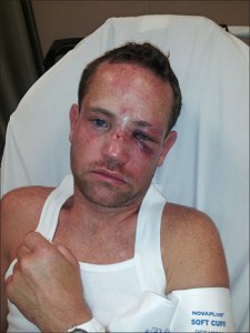 It’s a shame that steroid﻿ saturated, sexist homophobes are invading every major