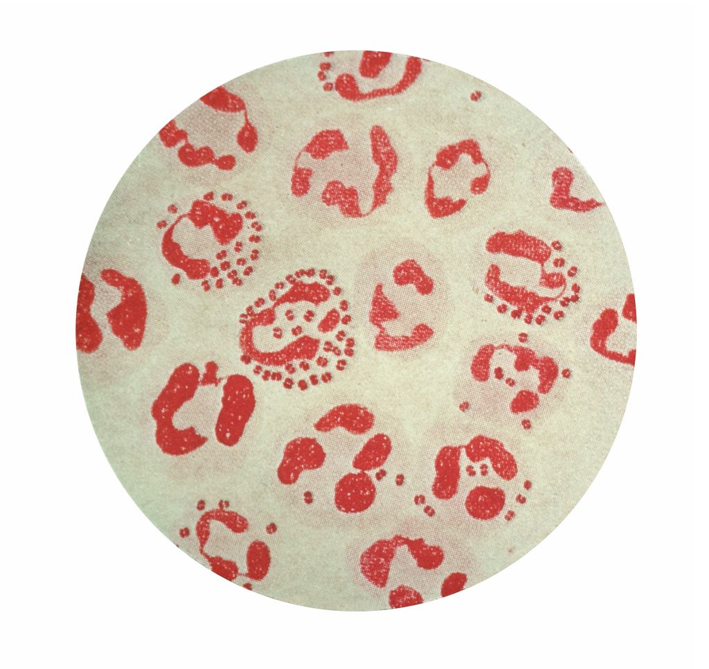 Photomicrograph of <i>Neisseria gonorrhoeae</i> (gonococcus) from urethral discharge (acute gonorrheae). gram stain. Causes Gonorrhea, second only to chlamydial infections in the number of cases reported to the CDC.Division of AIDS, STD, and TB Laboratory Research_Neisseria gonorrhoeae Gonorrheawww.cdc.gov/ncidod/dastlr/gcdir/gono.htmlS-11, slide 1; C 57576