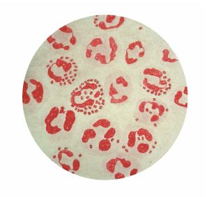 Photomicrograph of <i>Neisseria gonorrhoeae</i> (gonococcus) from urethral discharge (acute gonorrheae). gram stain. Causes Gonorrhea, second only to chlamydial infections in the number of cases reported to the CDC.Division of AIDS, STD, and TB Laboratory Research_Neisseria gonorrhoeae Gonorrheawww.cdc.gov/ncidod/dastlr/gcdir/gono.htmlS-11, slide 1; C 57576