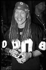 Appetite for reconstruction: Axl.