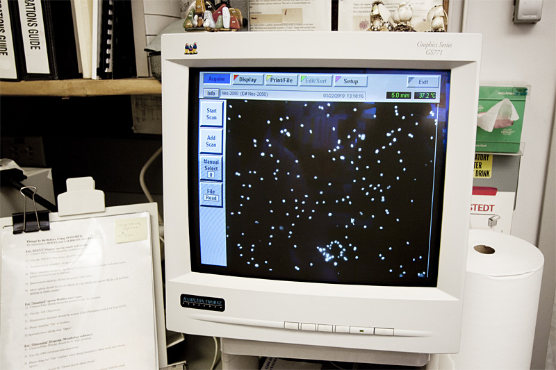 These are sperm, as they look on a UW lab computer.