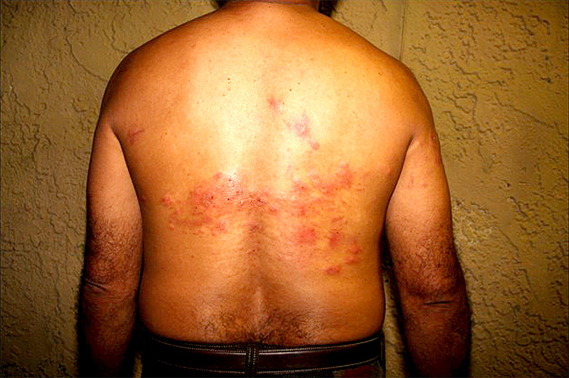 Kidnappers tortured this hostage by submerging him in water while Tasering him.