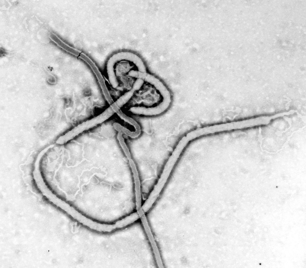 The virus. Courtesy of the Centers for Disease Control and Prevention