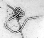 The virus. Courtesy of the Centers for Disease Control and Prevention