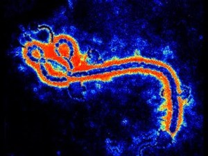 Last week, Scott Lindquist, the state Department of Health’s communicable disease epidemiologist,