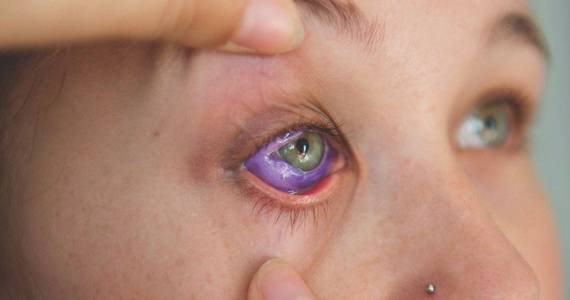 Proposal Calls For Banning Eye Tattoos in Washington State