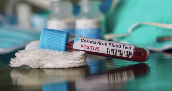 King County COVID-19 death total hits 87